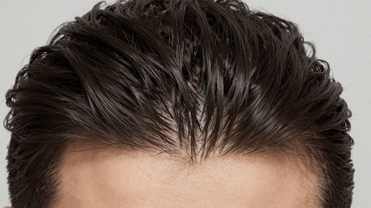 Detalhe da nuca com cabelo denso e saudável, representando a área doadora no transplante capilar
