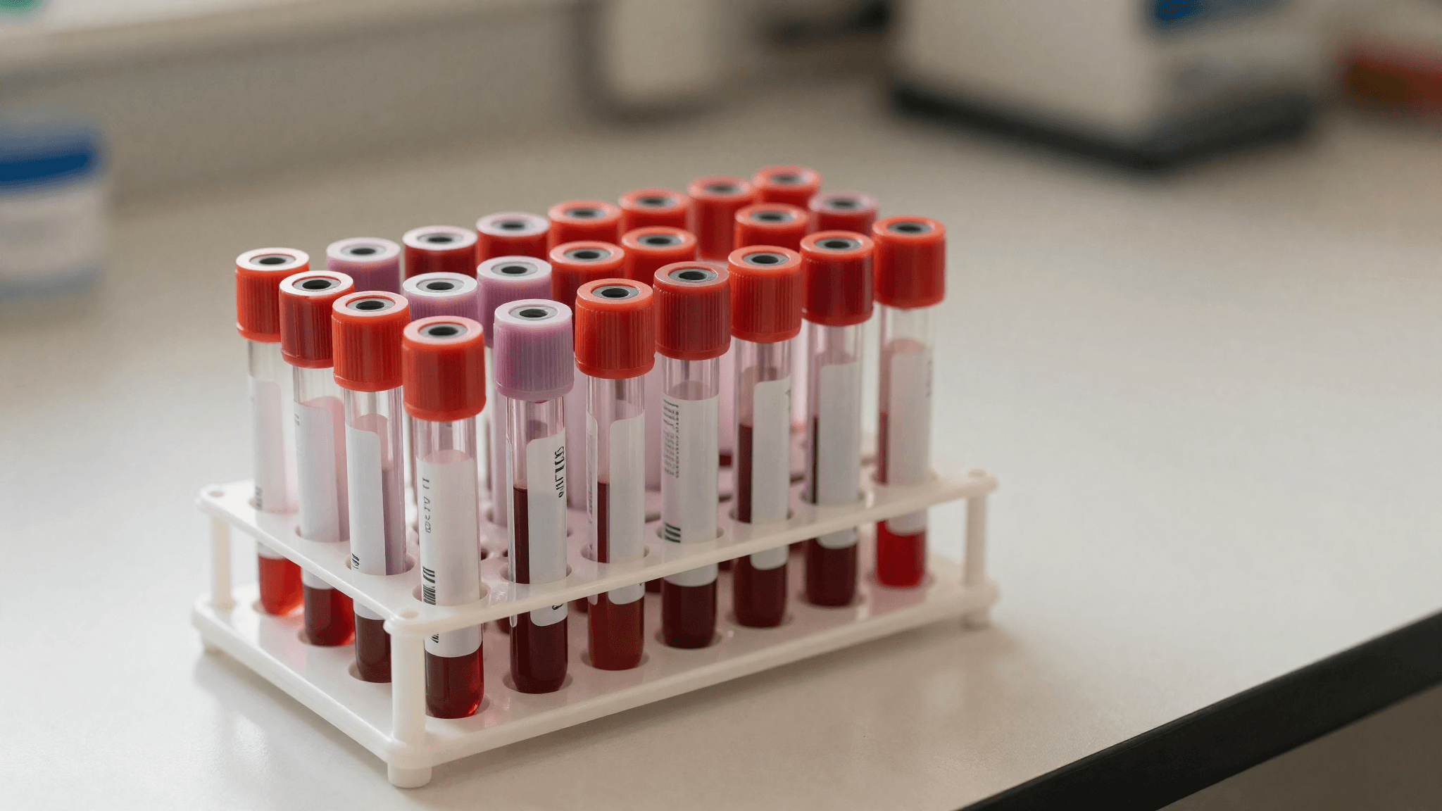 Tubos de exame laboratorial organizados em uma bancada clínica, representando os exames pré-operatórios do transplante capilar